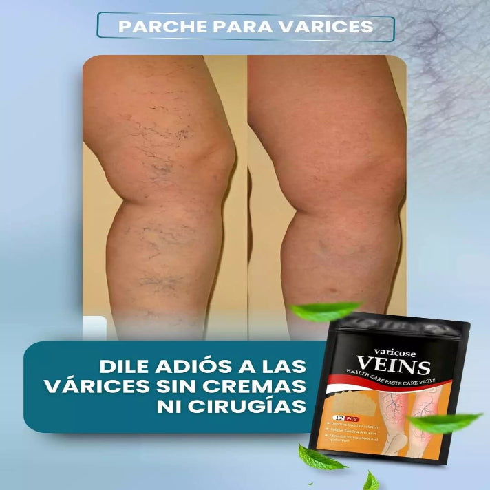 6X1 PACKS DE PARCHES ANTI VARICES + REGALOS ESPECIALES🎁